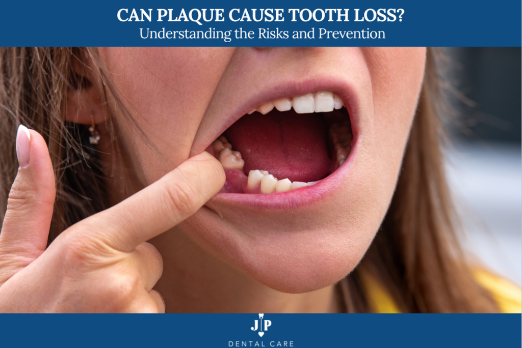 Can Plaque Cause Tooth Loss Understanding the Risks and Prevention