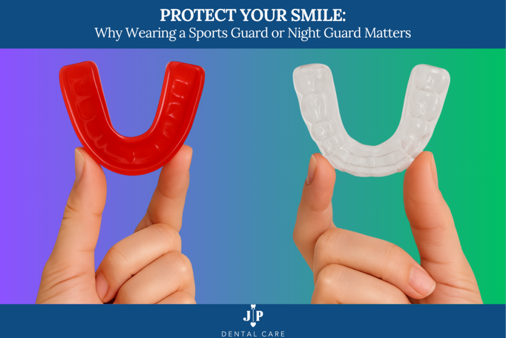 Protect Your Smile Why Wearing a Sports Guard or Night Guard Matters